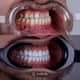 Slider image (9) Aesthetic Dental Care Costa Rica